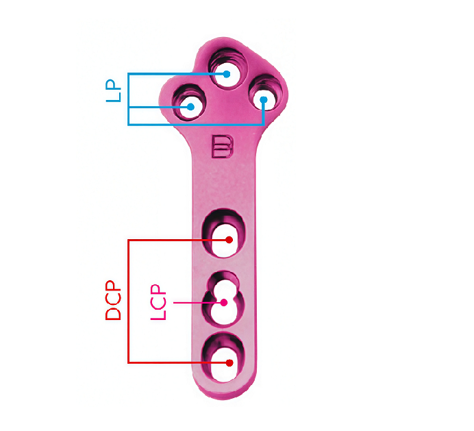 Пластина TPLO "Лист Клевера", блокируемая компрессионная, D2.7, BALF