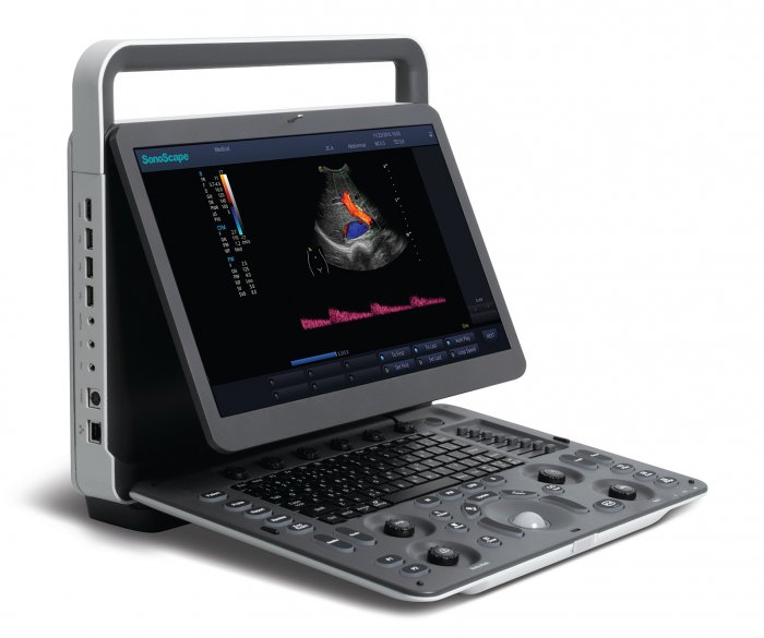 Аппарат ультразвуковой, диагностический, E1, SONOSCAPE
