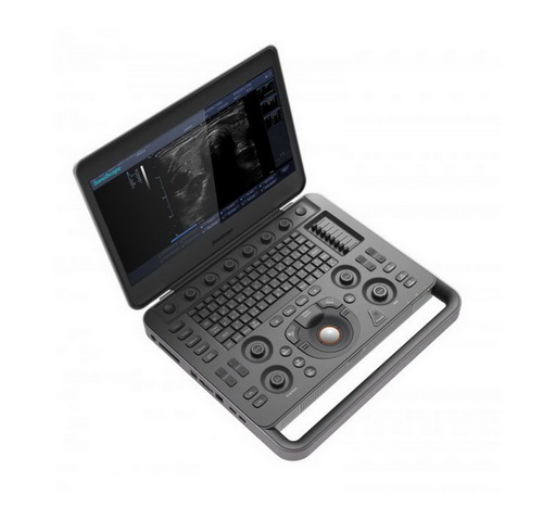 Аппарат ультразвуковой, диагностический, S2N, SONOSCAPE